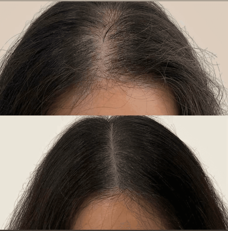 میکرو اسکالپ